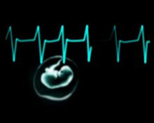 I-sza Nagroda na Multimedia Szajna Festiwal <br>za film - Dziekuję Ci, Mamo - Agata Prętka